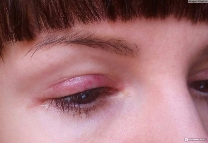 Татуаж вій (27 фото): як робиться? Догляд після перманентного макіяжу. Коли можна фарбувати очі після татуажу століття? Особливості биотатуажа