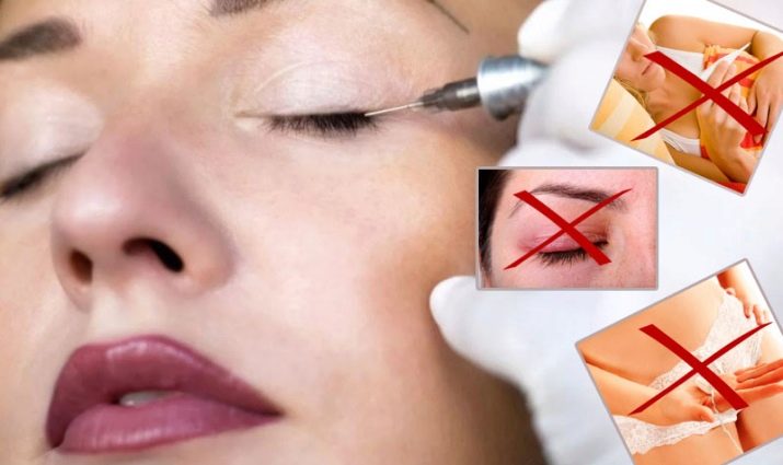 Татуаж вій (27 фото): як робиться? Догляд після перманентного макіяжу. Коли можна фарбувати очі після татуажу століття? Особливості биотатуажа