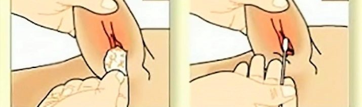 Тайські риджбеки (79 фото): опис породи, особливості характеру цуценят і дорослих собак, відгуки власників риджбеків