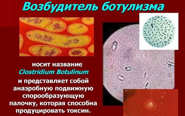 Вакуумні упаковки: як упакувати речі вакуумом в домашніх умовах? Термін зберігання в плівці, рулонних і рифлених пакетах