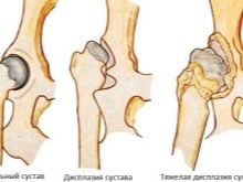 Вельш-спрингер-спанієль (28 фото): опис уельської породи, особливості змісту цуценят і дорослих собак