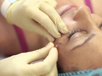 Як підтягнути овал обличчя? 48 фото Вправи для підтяжки в домашніх умовах, як прибрати носогубні складки