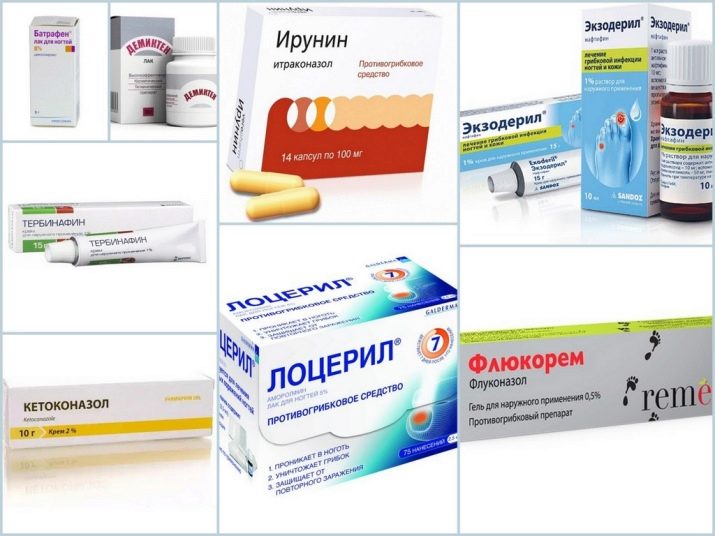 Як розм’якшити нігті на ногах, щоб було легше підстригти? Чим швидко розпарити нігті у літніх людей перед стрижкою?