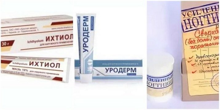 Як розм’якшити нігті на ногах, щоб було легше підстригти? Чим швидко розпарити нігті у літніх людей перед стрижкою?