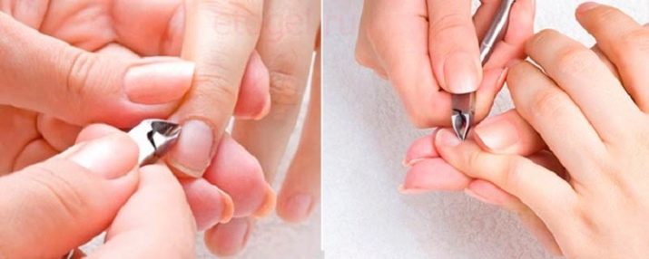 Як за 1, 2 і 3 дні відростити нігті? Як можна за пару днів в домашніх умовах швидко виростити довгі нігті на руках?
