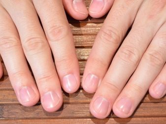 Зі скількох років можна нарощувати нігті? 22 фото Можна робити нарощування гелем дітям 13 і 14 років?