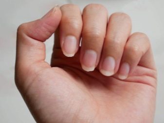 Зі скількох років можна нарощувати нігті? 22 фото Можна робити нарощування гелем дітям 13 і 14 років?