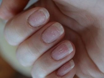 Зі скількох років можна нарощувати нігті? 22 фото Можна робити нарощування гелем дітям 13 і 14 років?