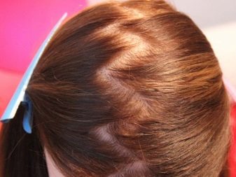 Зачіски з гумками (35 фото): укладання з маленькими силіконовими резиночками і обідком на короткі або довгі волосся