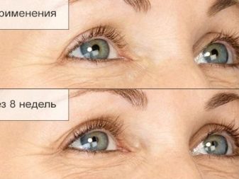 Засоби для росту вій: кращі засоби для зміцнення, активатори та стимулятори швидкого росту вій. Індійські, корейські та інші засоби. Відгуки покупців