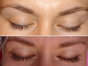 Засоби для росту вій: кращі засоби для зміцнення, активатори та стимулятори швидкого росту вій. Індійські, корейські та інші засоби. Відгуки покупців